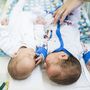 Koraszülött ikerpár a Heim Pál Gyermekkórház Madarász Utcai Részlegének Koraszülött Osztályán