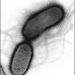 Elektronmikroszkópos felvétel az E. coli baktériumról