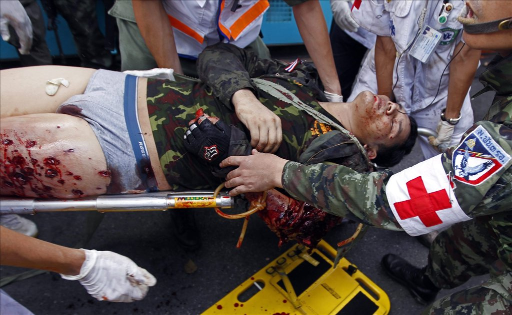Sebesült thaiföldi katona