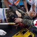 Sebesült thaiföldi katona