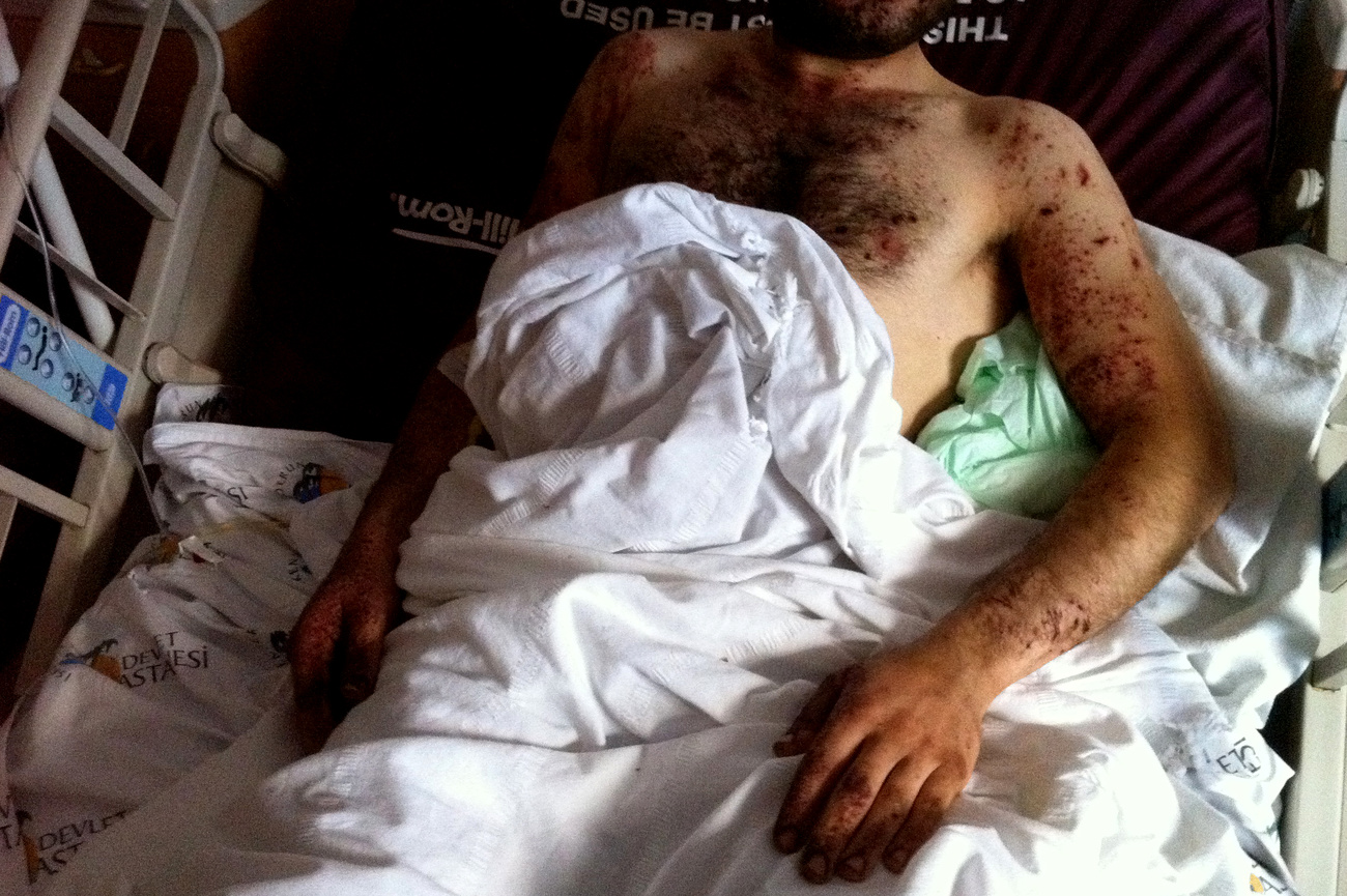 Sebesült szír férfi török kórházban