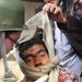Fejsérülést szenvedett egyiptomi tüntető