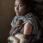 A 12 éves Pari Tamang egy kathmandui közkórházban, akinek a keze sérült meg a földrengésben