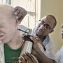 Tanzániában körülbelül 15 ezer főből egy albínó születik, akiket az állam minden erővel próbál megvédeni a boszorkánydoktorok uszításai ellen. De nincs hatása: a talizmánként használt testrészek a népi hiedelem szerint jó szerencsét hoznak a viselőiknek, ezért évről-évre nő a meggyilkolt albínók száma.