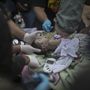 Harcokban megsebesült iraki kisbabát részesítenek elsõsegélyben egy tábori kórházban az észak-iraki Moszulban.