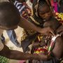 Orvosok vizsgálnak egy súlyosan alultáplált, 18 hónapos babát Timbuktuban. A WHO szerint a környék gyerekeinek 15 százaléka él hasonló helyzetben. 