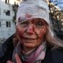 Sebesült nő egy légitámadás után Harkovban 2022. február 24-én
