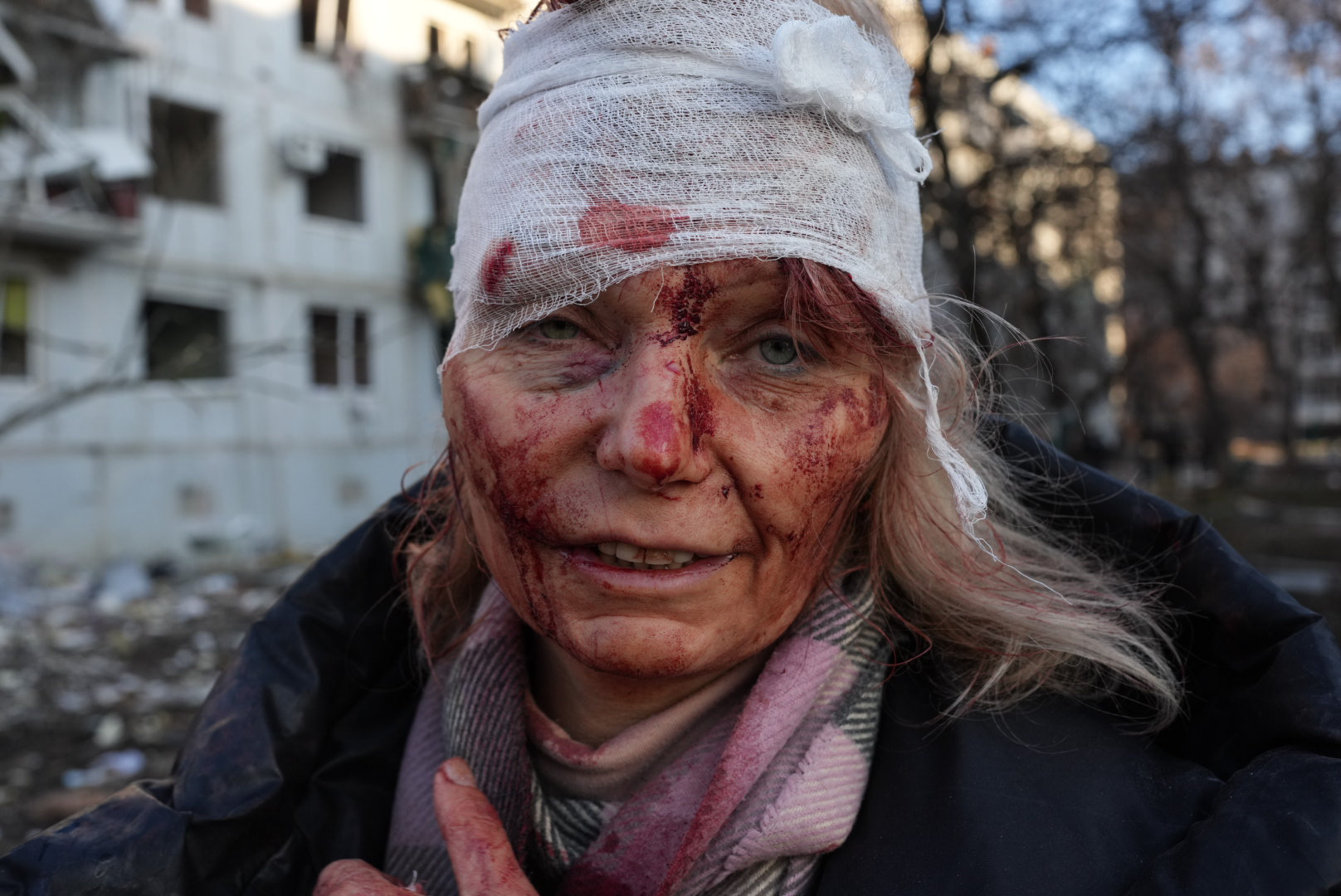 Sebesült nő egy légitámadás után Harkovban 2022. február 24-én