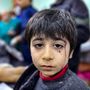 Egy sérült gyermek várja az ellátást Idleb tartományban, Szíriában 2023. február 6-án