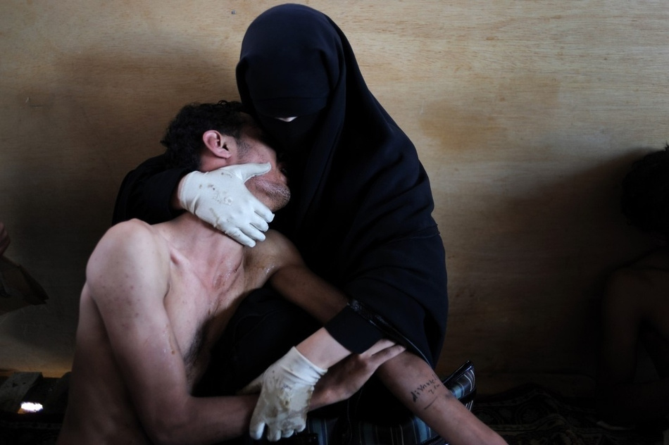 2011. Sebesült rokonát szorongató nő egy tábori kórházként használt jemeni mecsetben.