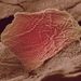 Égési sérülés bőrsejtje elektronmikroszkóp alatt – a fotós véletlenül leforrázta magát levessel, ezután készítette a képet
