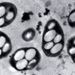 A baktériumok belső felépítése elektronmikroszkópos felvételen.
