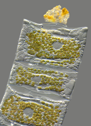 A tizedik helyezett  - A Nostoc commune kékbaktértium különálló telepei