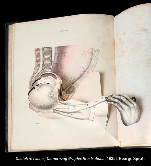 Anatómiai atlasz, 1911-ből. Elsősorban mumifikált testekről készített fényképeket mutat be.