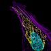 Emberi csontrák (osteosarcoma), aktinszálakkal (lila színű), mitokondriummal (sárga) és a DNS-sel (kék)


Nagyítás: 63x


Fotós: Dylan Burnette, Nemzeti Egészségügyi Intézet (USA, Bethesda, Maryland)