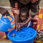 A 13 hónapos Fariana kezet mos, mielőtt különleges táplálási kezelést kapna Timbuktuban.
